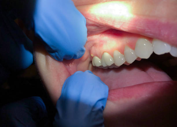 Best Pediatric Emergency Dentist in De Soto, IL