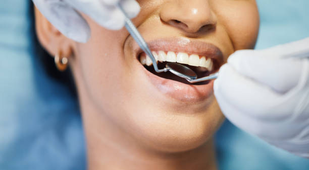 Best Emergency Tooth Extraction in De Soto, IL
